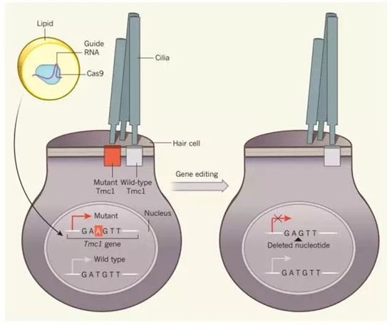 Nature：华人学者联手带来治疗耳聋的基因疗法