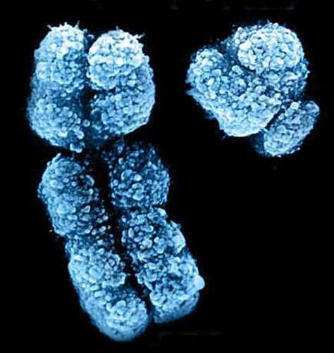 Nat&nbsp;Genet：科学家在Y染色体上鉴别出能抵御白血病的保护性基因