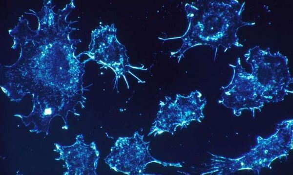 Cell&nbsp;Rep：癌症中基因调控的改变或许远比预期更为普遍