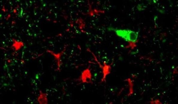 多篇文章解读科学家们如何鉴别出引发疾病的风险基因？