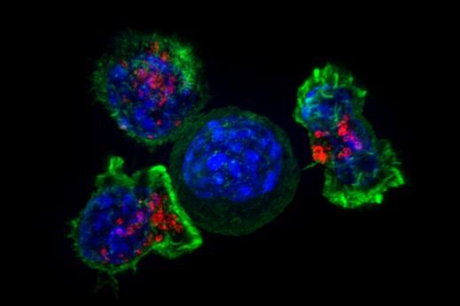 Nature：揭秘BRCA1基因功能有望帮助开发治疗乳腺癌和卵巢癌的新型疗法
