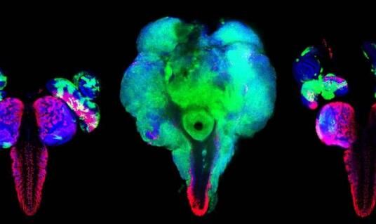 Cell&#160;Rep：科学家有望成功消灭表达RAS癌基因的肿瘤细胞
