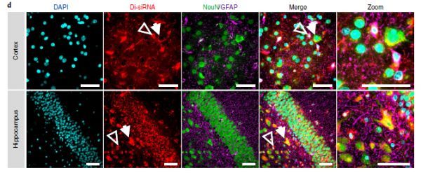 Nat&#160;Biotechnol突破：新型二价siRNA持续有效调控中枢神经系统基因表达